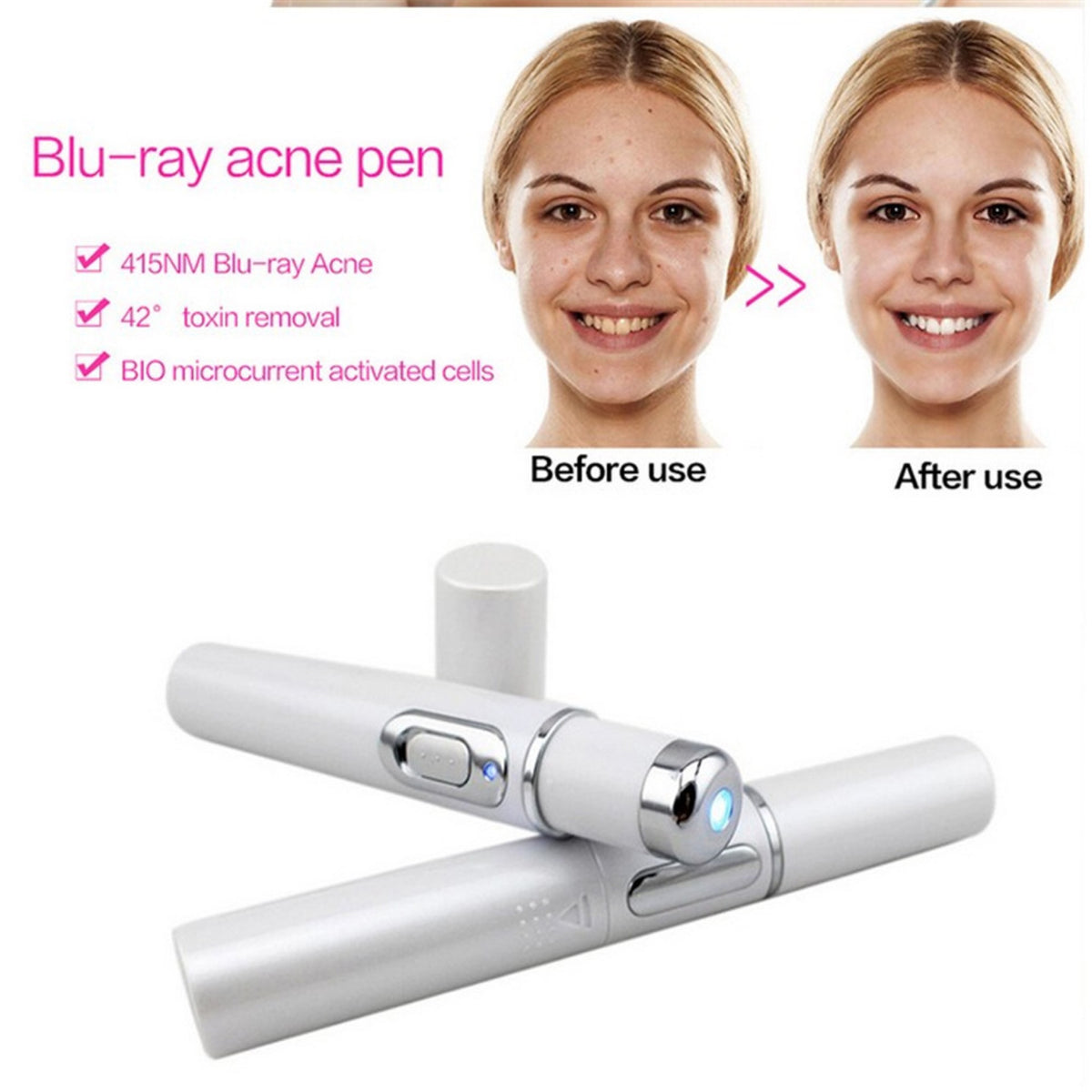 Blue Light Therapy Acne Laser Pen Soft Scar Wrinkle Removal - Glamour Hills